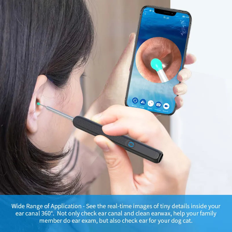 ClearHear Pro - Precision Ear Wax Remover